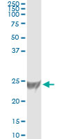 5 - RRAS Antibody (monoclonal) (M01) AT3727a