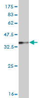 1 - RTKN Antibody (monoclonal) (M01) AT3733a