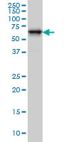 1 - RTKN Antibody (monoclonal) (M01) AT3733a