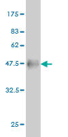 1 - RTN2 Antibody (monoclonal) (M05) AT3734a
