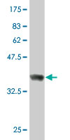 1 - RUFY1 Antibody (monoclonal) (M01) AT3735a