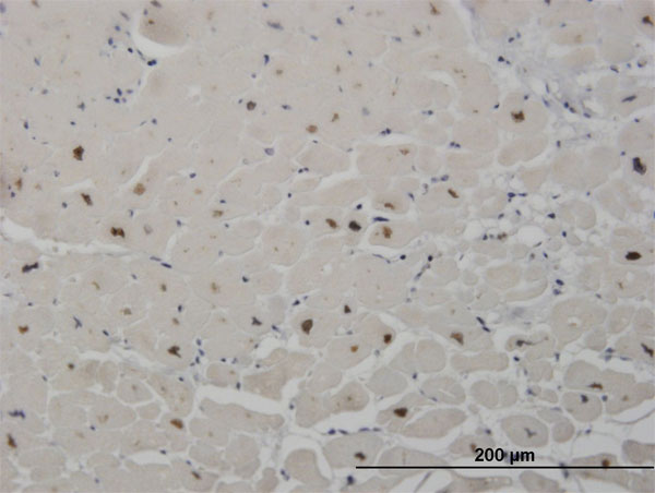 2 - SALL2 Antibody (monoclonal) (M10) AT3769a