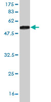 1 - SALL2 Antibody (monoclonal) (M10) AT3769a