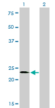 1 - SALL2 Antibody (monoclonal) (M10) AT3769a