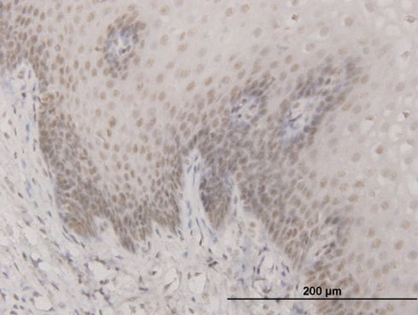 2 - SAP30 Antibody (monoclonal) (M02) AT3771a