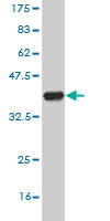 1 - SAP30 Antibody (monoclonal) (M02) AT3771a