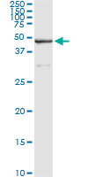 5 - SAV1 Antibody (monoclonal) (M02) AT3774a