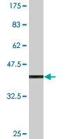 1 - SC65 Antibody (monoclonal) (M01) AT3776a