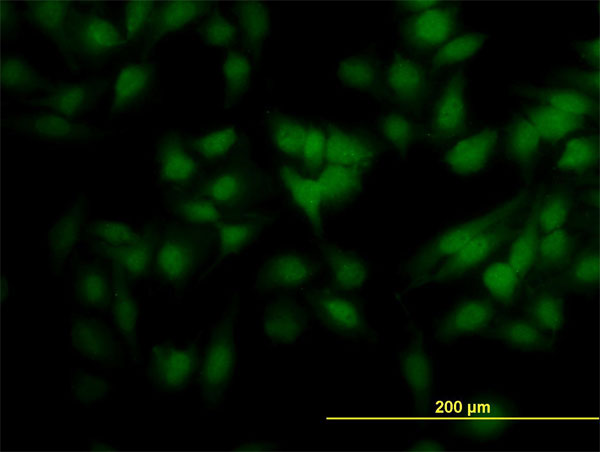 3 - SCAND2 Antibody (monoclonal) (M01) AT3779a