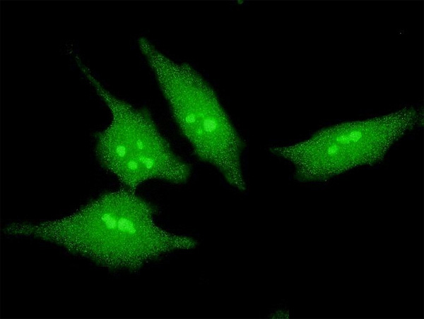 3 - SCAND2 Antibody (monoclonal) (M02) AT3780a