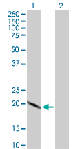 1 - SCAND2 Antibody (monoclonal) (M02) AT3780a