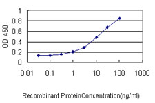 10 - SCGB1A1 Antibody (monoclonal) (M01) AT3785a