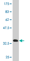 1 - SCGB1A1 Antibody (monoclonal) (M11) AT3786a