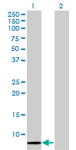 1 - SCGB1A1 Antibody (monoclonal) (M11) AT3786a
