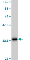 1 - SCGB3A2 Antibody (monoclonal) (M01) AT3787a
