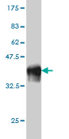 1 - SCMH1 Antibody (monoclonal) (M01) AT3788a