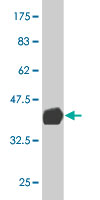 1 - SCMH1 Antibody (monoclonal) (M02) AT3789a