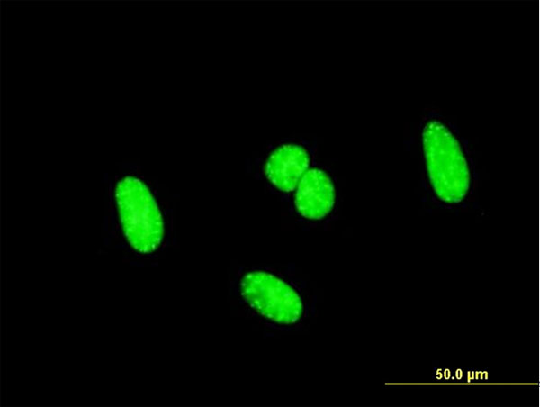 3 - SCML1 Antibody (monoclonal) (M01) AT3790a