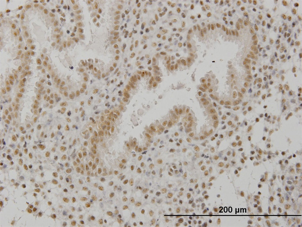 2 - SCML1 Antibody (monoclonal) (M01) AT3790a