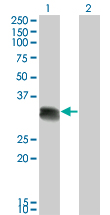 1 - SCML1 Antibody (monoclonal) (M01) AT3790a