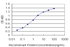 10 - SCN11A Antibody (monoclonal) (M04) AT3791a