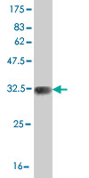 1 - SCN11A Antibody (monoclonal) (M04) AT3791a