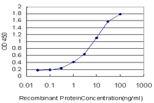 10 - SCN2B Antibody (monoclonal) (M01) AT3792a
