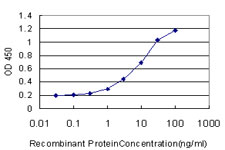 10 - SCN3A Antibody (monoclonal) (M01) AT3793a