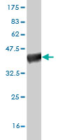 1 - SCN3A Antibody (monoclonal) (M01) AT3793a