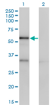 1 - SERPINA10 Antibody (monoclonal) (M02) AT3816a