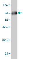 1 - SERPINA12 Antibody (monoclonal) (M01) AT3817a