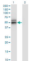 1 - SERPINA12 Antibody (monoclonal) (M01) AT3817a