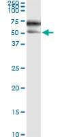5 - SERPINA3 Antibody (monoclonal) (M01) AT3818a