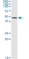 5 - SERPINB2 Antibody (monoclonal) (M08) AT3821a