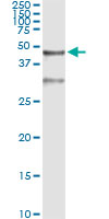 5 - SERPINB3 Antibody (monoclonal) (M01) AT3822a