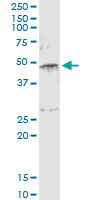 5 - SERPINE1 Antibody (monoclonal) (M01) AT3824a