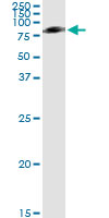 5 - SERPING1 Antibody (monoclonal) (M01) AT3826a