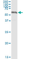 5 - SESN2 Antibody (monoclonal) (M03) AT3830a
