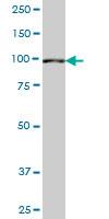 1 - SETDB2 Antibody (monoclonal) (M07) AT3833a