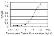 10 - SETX Antibody (monoclonal) (M05) AT3834a