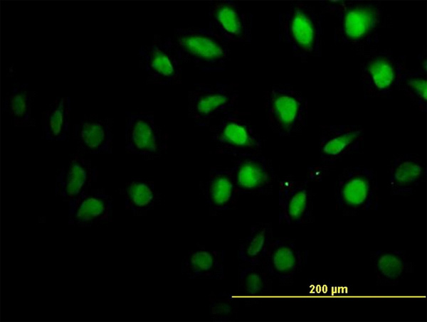 3 - SETX Antibody (monoclonal) (M05) AT3834a