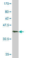 1 - SETX Antibody (monoclonal) (M05) AT3834a