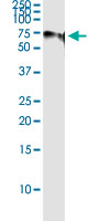 5 - SF1 Antibody (monoclonal) (M01) AT3835a