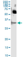 5 - SFN Antibody (monoclonal) (M01) AT3840a