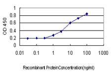 10 - SFRS6 Antibody (monoclonal) (M01) AT3847a