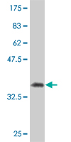 1 - SFRS6 Antibody (monoclonal) (M01) AT3847a