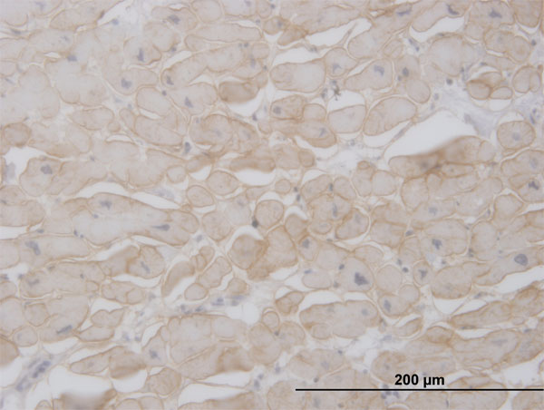 2 - SGCB Antibody (monoclonal) (M01) AT3852a