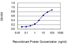 10 - SGCB Antibody (monoclonal) (M02) AT3853a