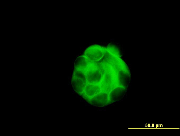 3 - SGCB Antibody (monoclonal) (M02) AT3853a