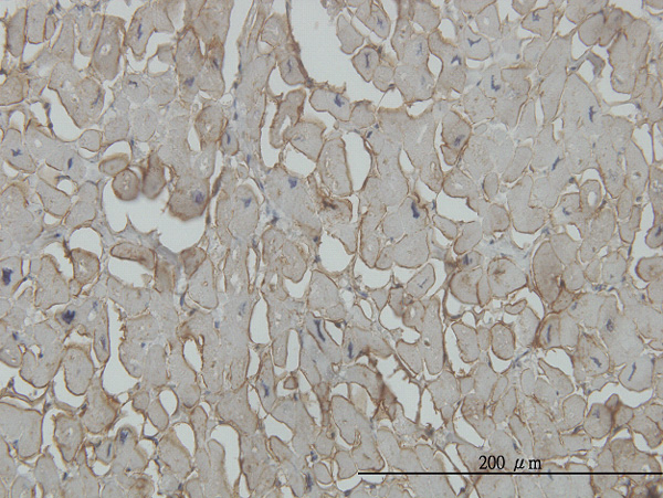 2 - SGCB Antibody (monoclonal) (M02) AT3853a